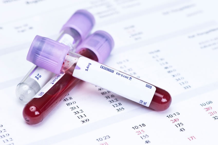 Giá xét nghiệm máu trong khám sức khỏe tổng quát hết bao nhiêu tiền?